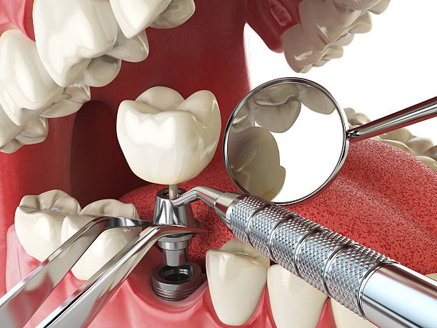 Best Emergency Orthodontic Repairs in Coloma, MI