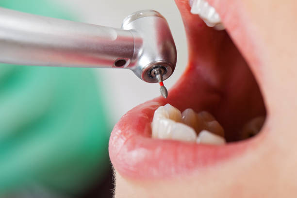 Best Emergency Broken Tooth Repair in Coloma, MI